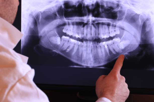Best Pediatric Emergency Dentist in Buffalo, TX